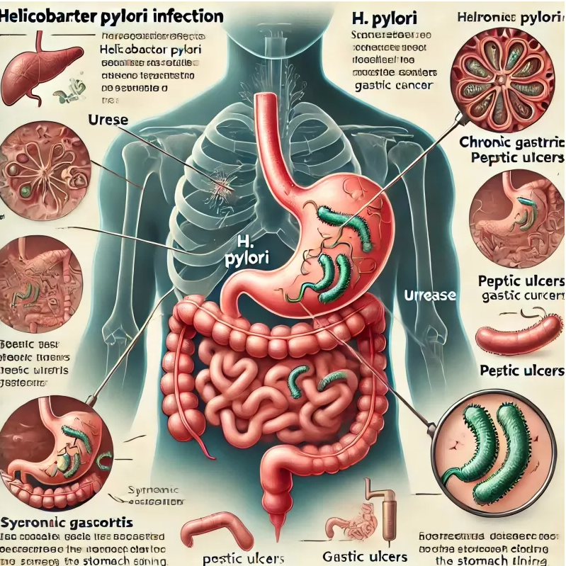 Proste badanie na obecność H. Pylori: rozwiązanie umożliwiające szybką i niezawodną diagnozę